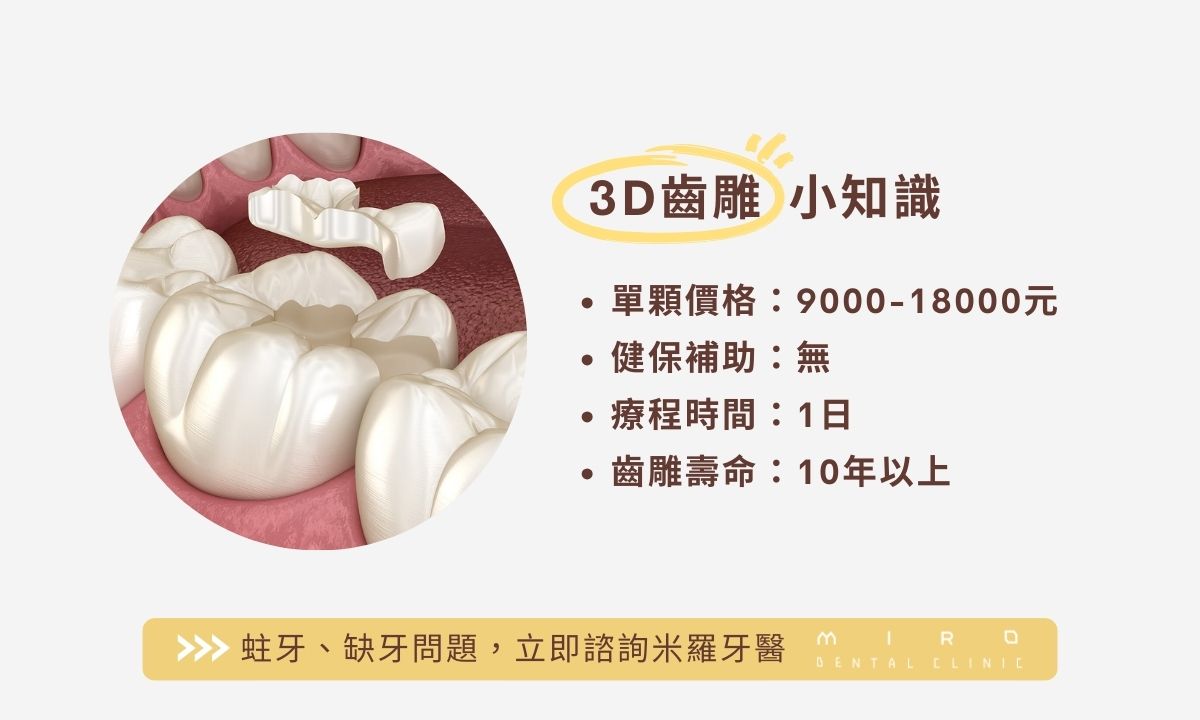 3D齒雕